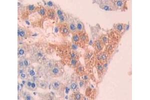 Used in DAB staining on fromalin fixed paraffin- embedded liver tissue (CRYBB1 anticorps  (AA 6-186))