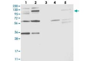 Western blot analysis of Lane 1: RT-4, Lane 2: U-251 MG, Lane 3: Human Plasma, Lane 4: Liver, Lane 5: Tonsil with OSBP2 polyclonal antibody . (OSBP2 anticorps)