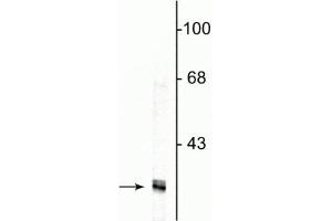 Western blot of HeLa cell lysate showing specific immunolabeling of the ~34 kDa fibrillarin protein. (Fibrillarin anticorps)