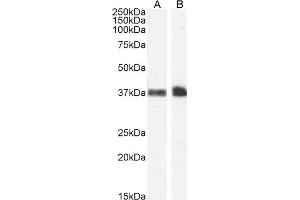 ABIN185486 (1 μg/mL) staining of Human Peripheral Blood Monocytes (A) and Kidney (B) lysate (35 μg protein in RIPA buffer). (CD235a/GYPA anticorps  (C-Term))