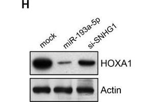 SNHG1 acts as a sponge of miR-193a-5p to activate HOXA1 expression. (HOXA1 anticorps  (AA 75-205))