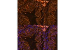 Immunofluorescence analysis of mouse testis using ZPBP antibody (ABIN7271569) at dilution of 1:100.