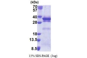SDS-PAGE (SDS) image for Leucine Rich Repeat Containing 59 (LRRC59) (AA 1-244) protein (His tag) (ABIN5853268)