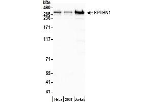 Western Blotting (WB) image for anti-Spectrin Beta, Non-Erythrocytic 1 (SPTBN1) (AA 2100-2150) antibody (ABIN7454694) (SPTBN1 anticorps  (AA 2100-2150))