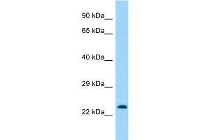 Host: Rabbit Target Name: TMEM114 Sample Type: Fetal Brain lysates Antibody Dilution: 1. (TMEM114 anticorps  (N-Term))