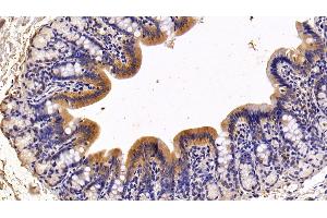 Detection of TFF2 in Rat Colon Tissue using Polyclonal Antibody to Trefoil Factor 2 (TFF2)