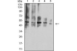 Western blot analysis using TNFRSF10D mouse mAb against Hela (1), L-02 (2), A549 (3), HepG2 (4), and COS7 (5) cell lysate.