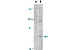 Western blot analysis of JPH1 in 293 cell lysate with JPH1 polyclonal antibody  at (A) 1 and (B) 2 ug/mL .