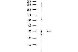 Western blot analysis of lysates from EC304 cells(heat-shock treatment), using OR2W1 Antibody at 1/1000 dilution.