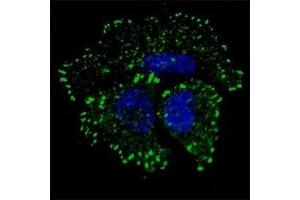 Fluorescent confocal image of MCF7 cells stained with phos-ERBB2 antibody at 1;100.
