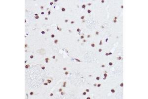 Immunohistochemistry of paraffin-embedded rat brain using S Rabbit pAb (ABIN6132631, ABIN6147390, ABIN6147391 and ABIN6224669) at dilution of 1:100 (40x lens). (SART1 anticorps  (AA 1-255))