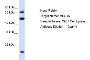 Host: Rabbit Target Name: MED16 Sample Type: 293T Whole Cell lysates Antibody Dilution: 1. (MED16 anticorps  (Middle Region))