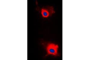 Immunofluorescent analysis of IRS1 (pS636) staining in MCF7 cells.