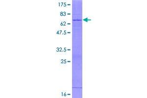 Image no. 1 for Heparan Sulfate (Glucosamine) 3-O-Sulfotransferase 1 (HS3ST1) (AA 1-307) protein (GST tag) (ABIN1307082)