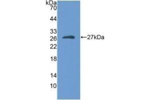 Detection of Recombinant MYH1, Human using Polyclonal Antibody to Myosin Heavy Chain 1 (MYH1)