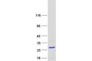 Validation with Western Blot