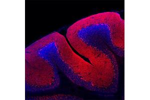 anti-GABA Transporter 1 (GAT1) (AA 585-599) antibody