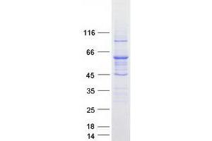 Validation with Western Blot