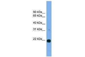 WB Suggested Anti-MITD1 Antibody Titration: 0.