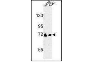 Western blot analysis of GFPT2 / GFAT2 Antibody (Center) in A2058, K562 cell line lysates (35ug/lane). (GFPT2 anticorps  (Middle Region))
