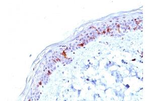 Formalin-fixed, paraffin-embedded human Skin stained with CD1a Mouse Monoclonal Antibody (O10). (CD1a anticorps)