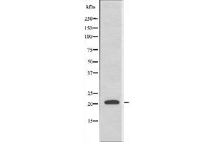 Western blot analysis of extracts from HepG2 cells, using MRPL41 antibody. (MRPL41 anticorps  (C-Term))