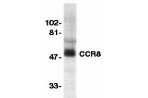 Western Blotting (WB) image for anti-Chemokine (C-C Motif) Receptor 8 (CCR8) (Extracellular Loop) antibody (ABIN1030839) (CCR8 anticorps  (Extracellular Loop))