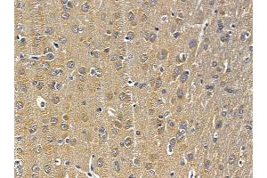 ABIN6258288 and ABIN6275675 at 1/100 staining rat brain tissue by IHC-P. (NSF anticorps  (Internal Region))