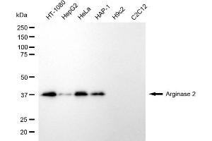 Western blotting analysis using arginase 2 antibody (ABIN7797645). (ARG2 anticorps)