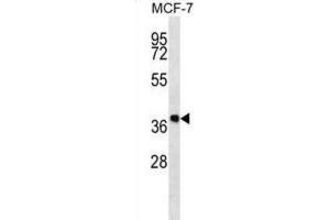 Western Blotting (WB) image for anti-Dehydrogenase/reductase (SDR Family) Member 7B (DHRS7B) antibody (ABIN2997289)