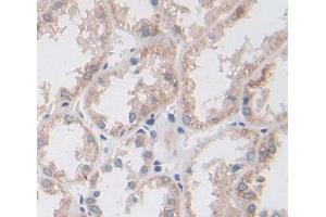 Used in DAB staining on fromalin fixed paraffin- embedded kidney tissue