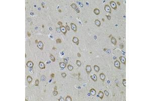 Immunohistochemistry of paraffin-embedded rat brain using PDE1B antibody (ABIN5971128) at dilution of 1/100 (40x lens). (PDE1B anticorps)