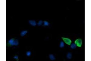 Image no. 2 for anti-Mitogen-Activated Protein Kinase Kinase 3 (MAP2K3) antibody (ABIN1499399)