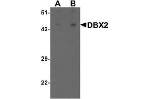 Western blot analysis of DBX2 in human kidney tissue lysate with DBX2 antibody at (A) 1 and (B) 2 ug/mL. (DBX2 anticorps  (N-Term))