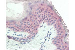 Anti-TRIM29 antibody IHC staining of human skin.
