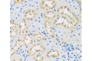 Immunohistochemistry of paraffin-embedded Rat kidney using LETMD1 Polyclonal Antibody at dilution of 1:100 (40x lens).