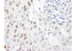 anti-Zinc Fingers and Homeoboxes 3 (ZHX3) (AA 150-200) antibody