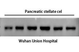Western Blot (WB) analysis: Please contact us for more details. (alpha-SMA anticorps)