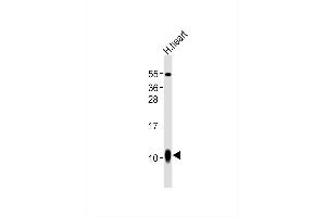 Anti--A1 Antibody at 1:1000 dilution + human heart lysates Lysates/proteins at 20 μg per lane. (S100A1 anticorps)