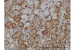 Image no. 1 for anti-F-Box and Leucine-Rich Repeat Protein 18 (FBXL18) (AA 1-111) antibody (ABIN466244) (FBXL18 anticorps  (AA 1-111))