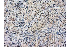Immunohistochemical staining of paraffin-embedded Human endometrium tissue using anti-UBA2 mouse monoclonal antibody. (UBA2 anticorps)