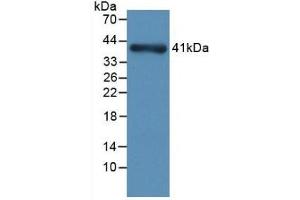 Detection of Recombinant NPHN, Rat using Monoclonal Antibody to Nephrin (NPHN) (Nephrin anticorps  (AA 39-106))