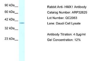 Human Daudi; WB Suggested Anti-HMX1 AntibodyTitration: 4. (HMX1 anticorps  (Middle Region))