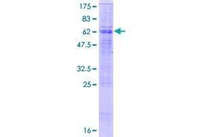 Image no. 1 for Solute Carrier Family 26, Member 5 (Prestin) (SLC26A5) (AA 1-447) protein (GST tag) (ABIN1320320)