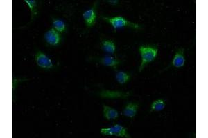 Immunofluorescence staining of U251 cells with ABIN7163226 at 1:50, counter-stained with DAPI. (PITPNA anticorps  (AA 1-270))