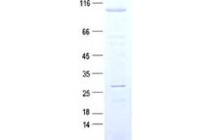 Validation with Western Blot