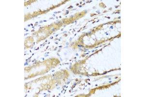 Immunohistochemistry of paraffin-embedded human stomach using UBE2L3 antibody. (UBE2L3 anticorps  (AA 73-212))