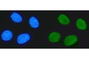 IF analysis of TRIM24 using anti-TRIM24 antibody (ABIN7602358). (TRIM24 anticorps  (AA 706-964))