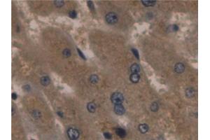 Detection of a1AGP in Human Liver Tissue using Monoclonal Antibody to Alpha-1-Acid Glycoprotein (a1AGP)