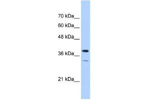 PGAM2 antibody used at 1 ug/ml to detect target protein.